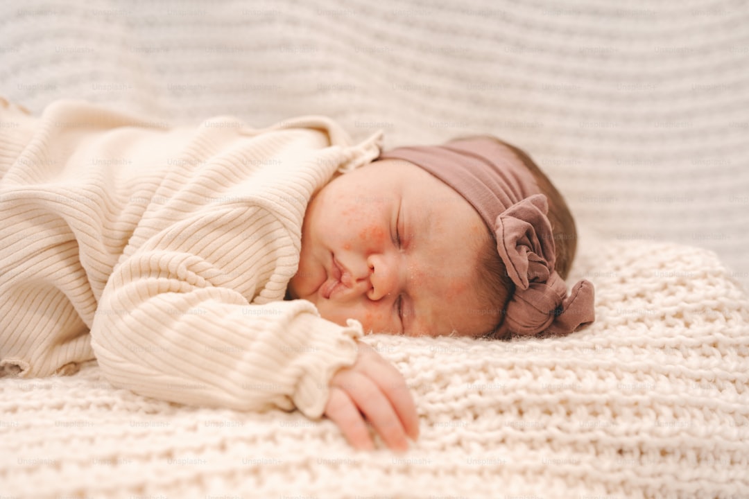 Baby Acne at 3 Weeks: What Ours Looked Like, How Long It Lasted, and What Actually Helped
